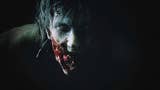 Come Resident Evil 2 mette in mostra l'orrore dei nostri corpi - articolo
