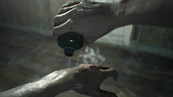 The poor mutilated hands of Ethan Winters in a Resident Evil 7 screenshot.