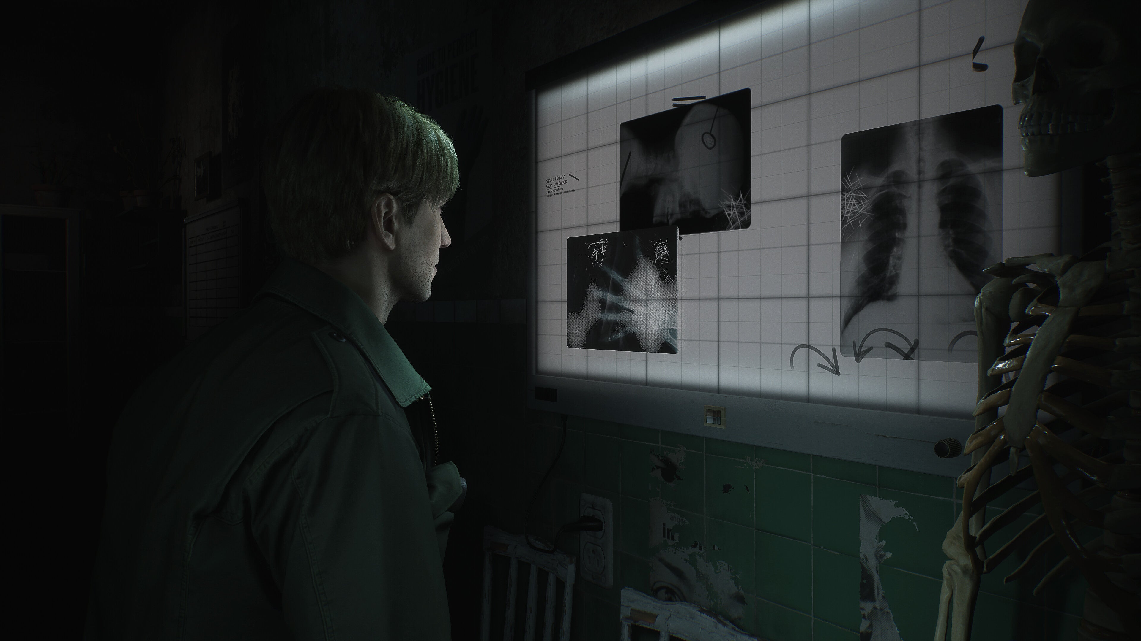 Bloober Team Asks Fans For Patience On Silent Hill 2 Remake, Says ...