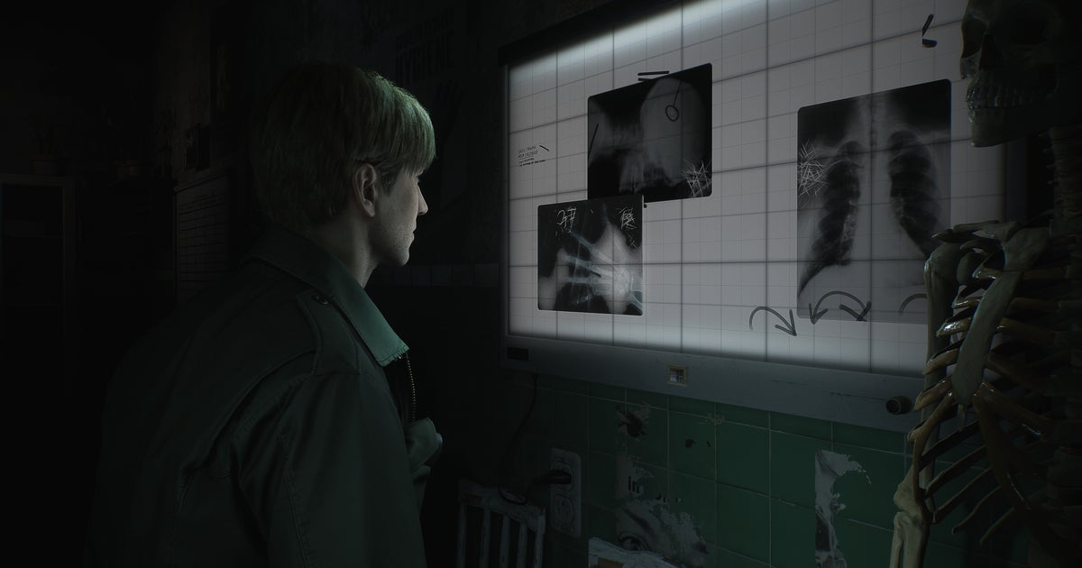 Das Remake von Bloober's Silent Hill 2 ist live mit einem kampforientierten Trailer