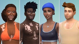 Four Sims with different vitiligo patterns in The Sims 4