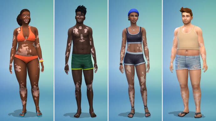 نمونه های ویتیلیگو در The Sims 4 (بدن)